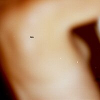 Skin - Dijon